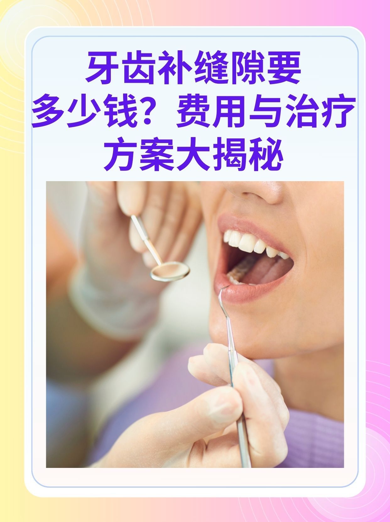 黄山补牙医保可以报销吗(补牙医保可以报销吗 哪些可以报销呢)